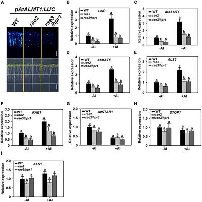 The THO/TREX Complex Component RAE2/TEX1 Is Involved in the Regulation of Aluminum Resistance and Low Phosphate Response in Arabidopsis